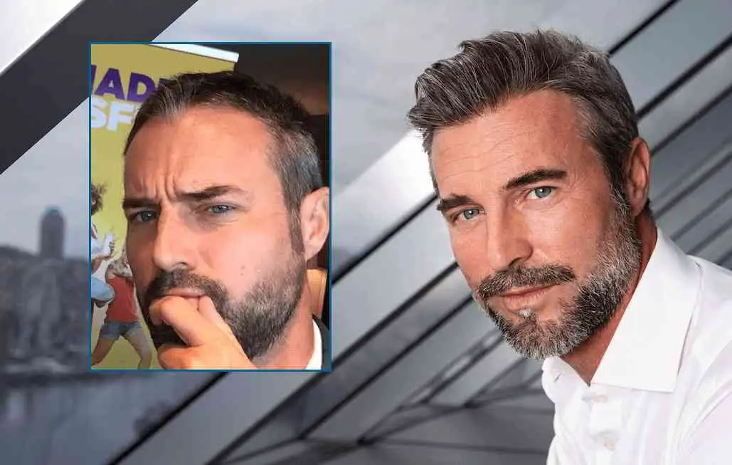 Flavio Montrucchio autotrapianto capelli
